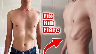 How to fix Rib Flare Full beginner tutorial 3 exercises [upl. by Ydnik635]