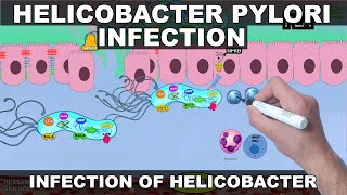 Helicobacter Pylori Pathogenesis  Detailed [upl. by Ahsiela]