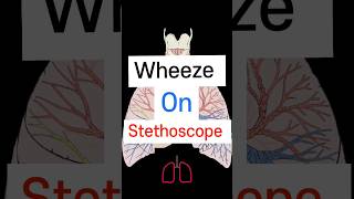 Wheeze on Stethoscope 🩺 Lung sound neetpg fmge medicalstudent [upl. by Alinna]