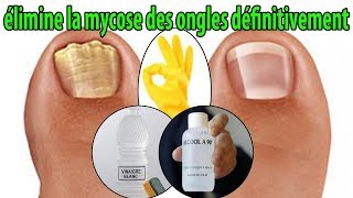 élimine la mycose des ongles définitivement  conseils [upl. by Auoh672]