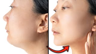 Kybella Double Chin Removal Explained [upl. by Anniroc]