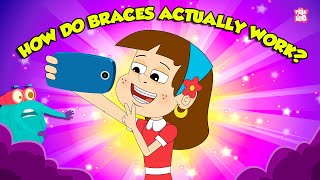 How Do Braces Work  How Teeth Aligners Work  Orthodontic Treatment  The Dr Binocs Show [upl. by Neelyaj]