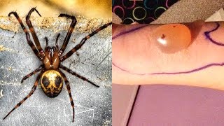 MOST Venomous Spiders On Earth [upl. by Jenny453]