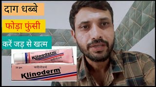 दाग धब्बे फोड़े फुंसियों के लिए आयुर्वेदिक इलाज klinoderm cream review [upl. by Lind]