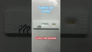 How to perform syphilis VDRL testing lab vdrl test lab technician bloodtest viralshorts labs [upl. by Maillw]