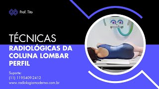 Técnicas Radiológicas da coluna lombar Perfil [upl. by Synned]