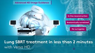 Lung SBRT treatment in less than 2 minutes with Versa HD [upl. by Avilla]