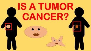 Is a Tumor Cancer or Not Is There a Difference Between Cancer and Tumor [upl. by Dviad]