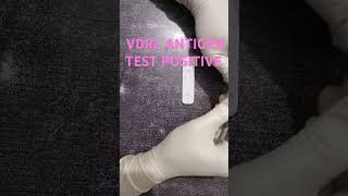 VDRL ANTIGEN TEST POSITIVE medicalcollegestudents youtubeshorts ytshorts lab [upl. by Neelrak]