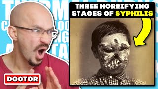 DOCTOR Reacts to The Three Horrifying Stages of Syphilis [upl. by Suhail94]