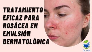 Crema para Rosácea Pápulopustulosa con Metronidazol Ivermectina y Alfa Bisabolol [upl. by Trebreh]