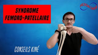 Soigner efficacement le syndrome fémoro patellaire  Conseil KINE et autoexercices [upl. by Aicxela397]