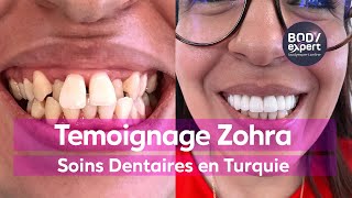 Témoignage Couronnes et Implant Dentaire en Turquie Zohra [upl. by Cohn973]