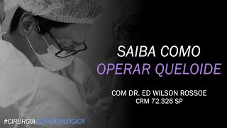 SAIBA COMO OPERAR QUELOIDE  DR ED WILSON ROSSOE  CIRURGIA DERMATOLÓGICA [upl. by Grose448]