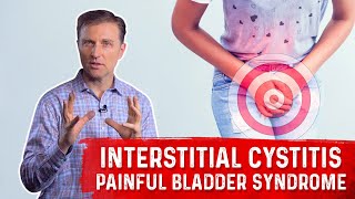 What is Interstitial Cystitis Painful Bladder Syndrome – Symptoms amp Remedy Covered by DrBerg [upl. by Rumpf620]