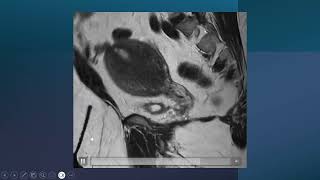 genitourinary cases part 4 [upl. by Robertson]