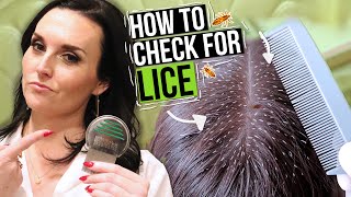 How to Check for Lice  5 Lice Treatment Tips from a Professional [upl. by Frasco153]