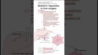 Sedative  hypnotics in liver surgery [upl. by Arima]