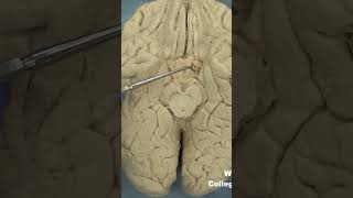 Parahippocampal gyrus uncusanatomyneuroanatomy cerebrumbraincortextemporallobelimbicsystem [upl. by Monreal257]