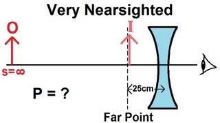 Physics  Optics Vision Correction 3 of 5 Very Nearsighted [upl. by Ahsenod899]