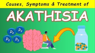 Akathisia by Antipsychotics  Causes Symptoms and Treatments [upl. by Akeirahs]