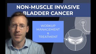 Management of NonMuscle Invasive Bladder Cancer [upl. by Pete]