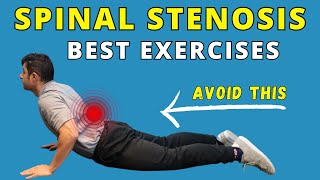 Best Exercises for Spinal Canal Stenosis Pain Relief [upl. by Yenruogis26]