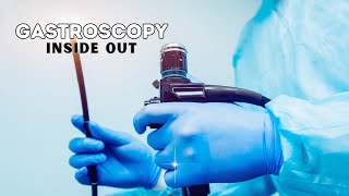 Gastrscopy Inside Out  Upper Endoscopy  Why and How Gastroscopy is done [upl. by Wynn849]