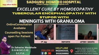 TUBERCULAR ENCEPHALOPATHY STUPOR MENINGITIS GRANULOMA  HYDRONEPHROSIS CURE Dr Sahadeo Wankhade [upl. by Nyrek]