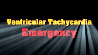 Ventricular Tachycardia Emergency [upl. by Rooke]