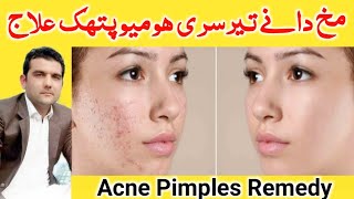 Acne Pimples Treatment in Pashto Language  wrinkles freckles remedy in pashto language  pukhto [upl. by Attenweiler]