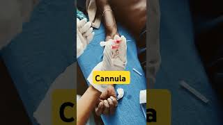 Cannula medico neetmotivation bscnursing youtubeshorts viral medicalcollegelife mbbs pw [upl. by Hcirteid647]