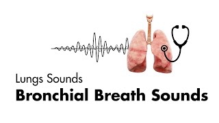 Bronchial Breath Sounds  Lung Sounds  Medzcool [upl. by Darees]