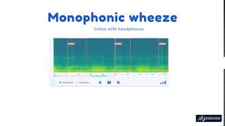 Lung sounds  monophonic wheeze [upl. by Annunciata613]