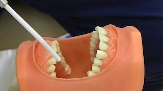 How to Apply Fluoride Varnish [upl. by Nwahsat]