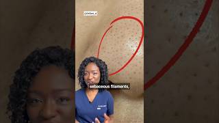 Black Dots on the Nose Sebaceous Filaments amp How To Get Rid Of Them  Products [upl. by Enelrae]