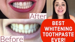 BEST WHITENING TOOTHPASTE EVER REVIEW Crest 3D White Brilliance [upl. by Ahsiekim]