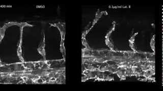 Dorsal migration of endothelial cells in zebrafish development [upl. by Ahseyt199]