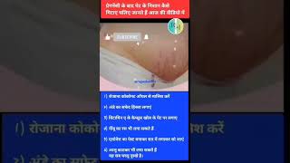 jotummereho line scar abdomen pregnancy femalestatus skincare scratch song mehmdidesign [upl. by Donaldson]