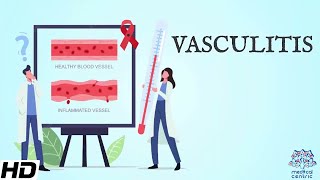 Vasculitis Everything You Need To Know [upl. by Isidor]