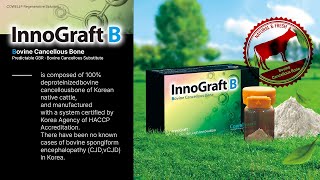 New Product Launch Introducing InnoGraft B with Clinical Case [upl. by Hrutkay]