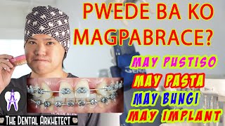 Pwede Ka Bang MagpaBRACES 40 [upl. by Alleen]