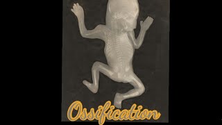 Ossification  Meaning  Pronunciation  Usage [upl. by Baer347]