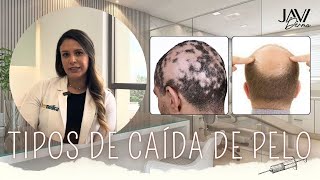 El motivo por el que se te cae el PELO I JAVI DERMA [upl. by Anawad173]