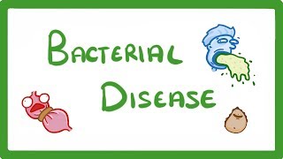 GCSE Biology  What Are Bacterial Diseases  Treatment and Prevention 37 [upl. by Nilra]