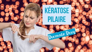 Kératose pilaire  boutons peau granuleuse poils incarnés comment se soigner  DermatoDrey [upl. by Savage]