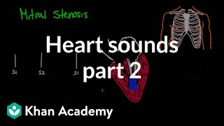 Systolic murmurs diastolic murmurs and extra heart sounds  Part 2  NCLEXRN  Khan Academy [upl. by Fenwick]