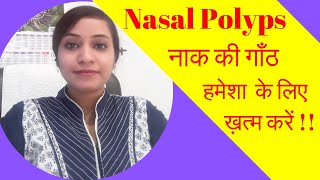 nasal polyps treatment  homeopathy for nasal polyps  nasal polyps homeopathic medicines  video [upl. by Aiuqat]