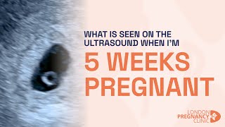 What would an ultrasound show at 5 weeks of pregnancy A London Pregnancy Clinic case study [upl. by Ardnat]