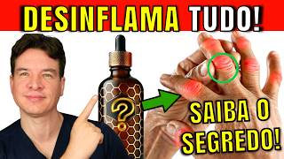 O 1 Melhor Antiinflamatório Natural para Artrite NÃO É O QUE VOCÊ PENSA  TOME PRÓPOLIS CERTO [upl. by Nahtanaoj]